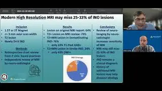 Internuclear Ophthalmoplegia INO on MRI