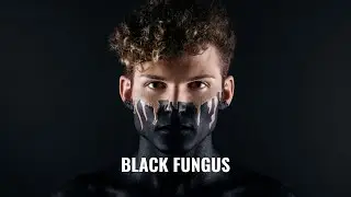 BLACK FUNGUS से बचाव (EVERYTHING YOU WANT TO KNOW ABOUT)