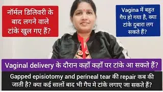 नॉर्मल डिलिवरी के बाद टांके खुल गए हैं । Gapped episiotomy और perineal tear repair कब की जाती है?