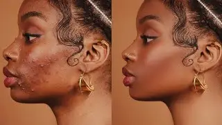 High-End Skin Retouching Beginner Photoshop Tutorial | Frequency Separation