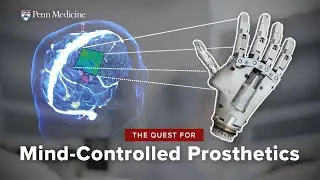 Thought-Controlled Prosthetics: A Brain-Computer Interface Breakthrough