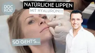 LIPPEN mit Hyaluron NATÜRLICH AUFSPRITZEN – so geht's – Dr. Rolf Bartsch