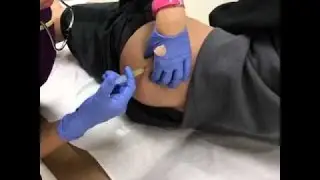 PIERDE EL GLÚTEO POR INYECCIÓN EN EL IMSS