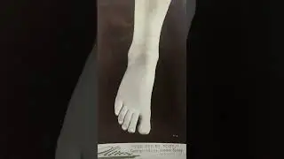 The Victorian Foot Fad