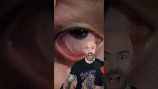HORRIFIC Parasites That May Be Inside You Right Now 2 #shorts
