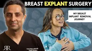 211 The ULTIMATE Guide to Breast Explant [Patient Journey] #explantsurgery #breastimplantremoval