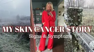 My Skin Cancer Story | Signs and Symptoms