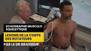 LESIONS DE LA COIFFE DES ROTATEURS - Echographie Musculo squelettique par le Dr Brasseur