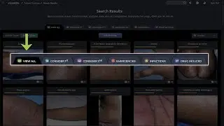 Viewing Differential Results
