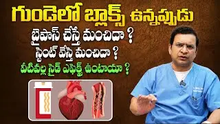 బైపాస్ మంచిదా ? స్టంట్ మంచిదా ? - Dr Movva Srinivas On Difference Between Stent and Bypass || SH