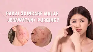 Jerawatan Setelah Mencoba Skincare Baru? Ini Perbedaan Breakout dan Purging!