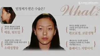 S프로포즈성형외과&피부과의 성형후기/리얼스토리