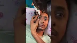 Когда переборщил с глазными каплями 😅