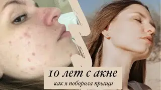 КАК Я ИЗБАВИЛАСЬ ОТ ПРЫЩЕЙ | как убрать пигментные пятна и постакне | средства от прыщей и постакне