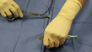 Beginning the Cushing