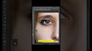Remove Dark Circles in Photoshop 