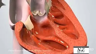 Nurses Zone(documentary)-by-Chipo James Mainda=Tetralogy of fallot (New version)