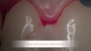 ANUG