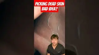 BAD IDEA? Picking Off Dead Skin  