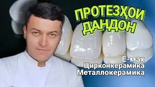 Дандонҳои садаф | Протезҳои гирифтанашаванда,  металлокерамика