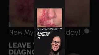 New Mystery Monday!! #grossanatomy #medical
