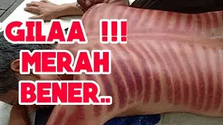 KEROKAN MASUK ANGIN MERAHNYA KEBANGETAN