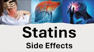 Statins-Side Effects