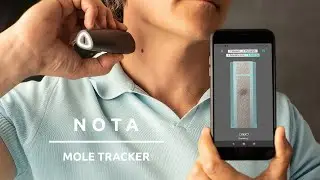Schneller Start NOTA mole tracker