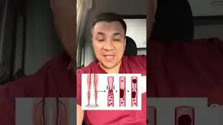 Почему у тебя мёрзнут ноги и ты не знаешь что с этим делать?