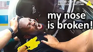 When Cops INJURED A Suspect And They ENJOY It