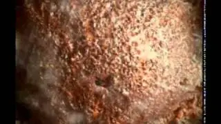 Жесть ....и после этого вы еще хотите курить?