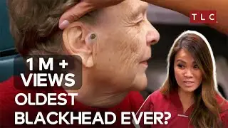 The 55-Year Blackhead Mystery! | Dr Pimple Popper TLC