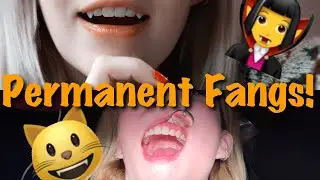 Permanent Fangs Pt. 2 / Repair! My Experience, Cost, Cons