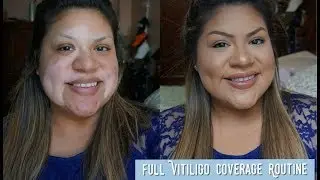 *UPDATED* Full Coverage Vitiligo Routine | Trae.Mendoza