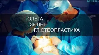 Пластика ягодиц. История преображения Ольги