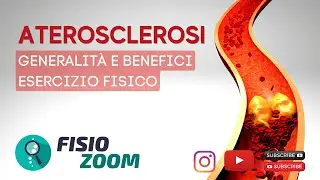Come prevenire l'ATEROSCLEROSI?   I benefici dell'esercizio fisico/ #FisioMap