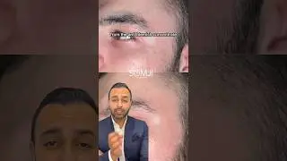 Before and After Blemish results with THIS ONE PRODUCT! | Dr Somji Skincare