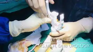 ZSR Circumcision in Surat
