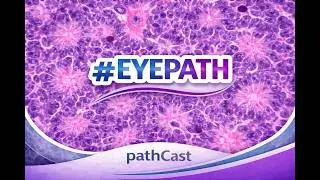 #EYEPATH