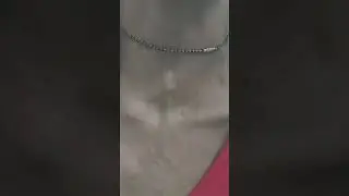 why this vein on neck getting dilated on speaking ?