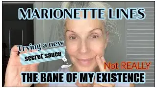 THOSE PESKY MARIONETTE LINES | WHAT TO DO | #loveyourage