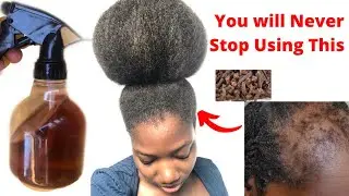 I didn’t expect it to work like this 🔥 Use twice a week for massive hair growth and thick hair