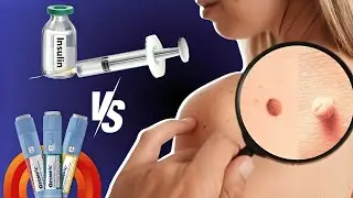 Ozempic vs Insulin: Which Is More Effective for Diabetes? (Doctor Reveals the Truth!)