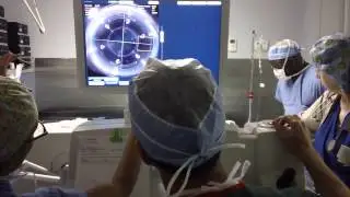 Bladeless Laser Cataract Surgery with Dr. Andrew Velazquez