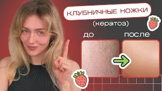 Как избавиться от КЕРАТОЗА и ВРОСШИХ ВОЛОС навсегда