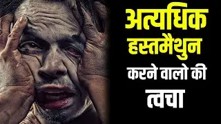 अत्यधिक ब्रह्मचर्य नाश करने वालो की त्वचा । ब्रह्मचर्य नाश करने वाले जरूर देखें। brahmacharya video
