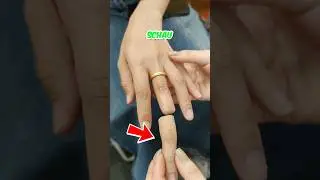 Eine UNGLAUBLICHE Fingerprothese! 😱