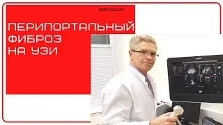 Перипортальный фиброза на УЗИ печени.