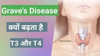 Grave's Disease || Autoimmune Disorder || Why T3 and T4 increased in grave's disease