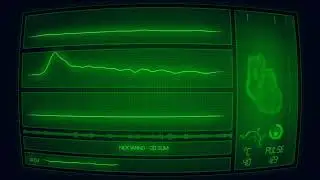 [FREE] MONEYBAGG YO Type Beat - DO SUM | Nick Ianno Beats